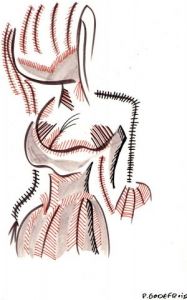 Dessin de napoldee: non voyante