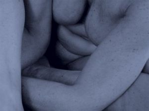 Photo de raymond la motte: difformité 05