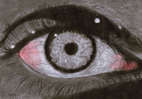 Coup de sang dans l'œil - Peinture - Patmor